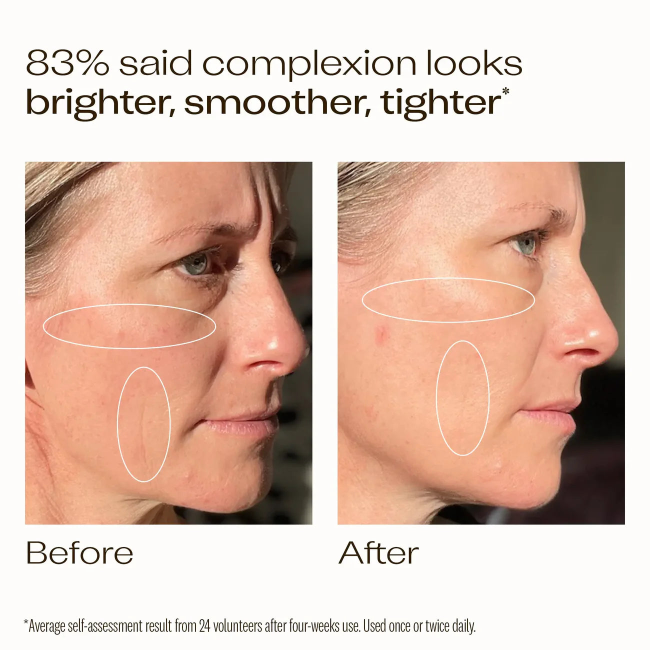 Trilogy 維C煥采強效精華 30毫升